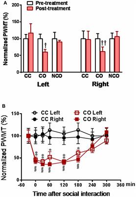 The Locus Coeruleus–Norepinephrine System Mediates Empathy for Pain through Selective Up-Regulation of P2X3 Receptor in Dorsal Root Ganglia in Rats